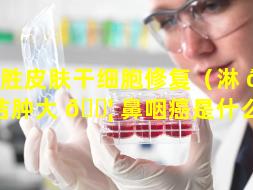 东胜皮肤干细胞修复（淋 🦅 巴结肿大 🐦 鼻咽癌是什么期）